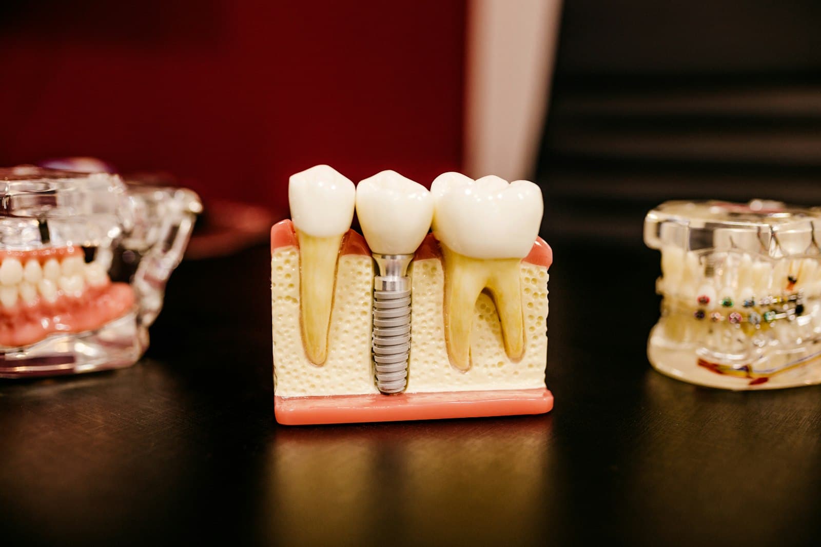 Dental Implants in Queens Village